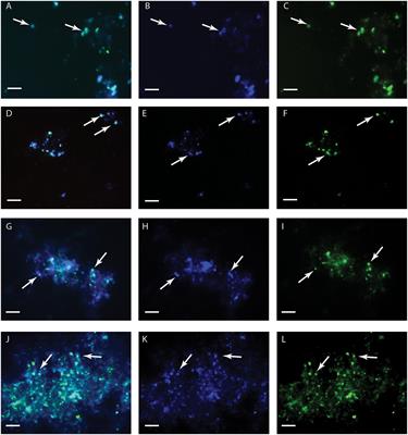 Exploring Fingerprints of the Extreme Thermoacidophile Metallosphaera sedula Grown on Synthetic Martian Regolith Materials as the Sole Energy Sources